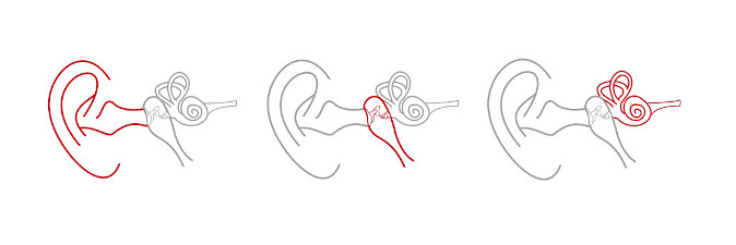 Revisiones Auditivas